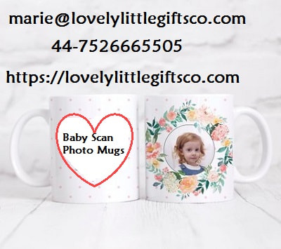 Baby Scan Photo Mugs