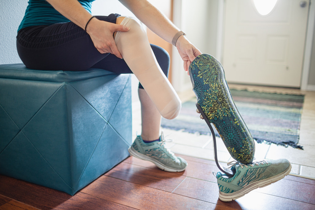 Amputee Placing Limb in Prosthetic Leg by Nadia M on 500px.com