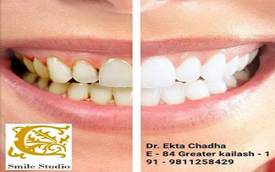 Best General Dentistry in South Delhi