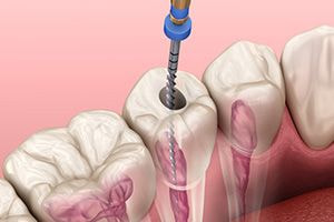 dental clinic in seawoods