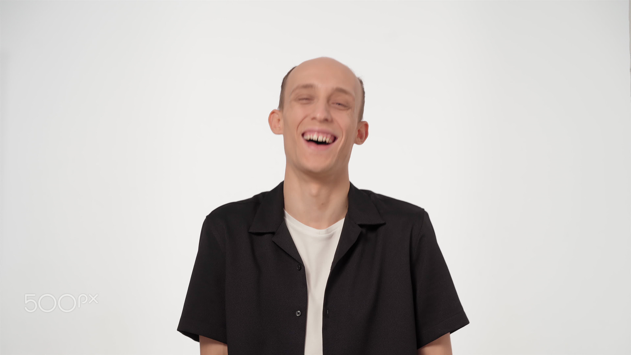 Handsome man with hair health problems, hair loss and baldness saying