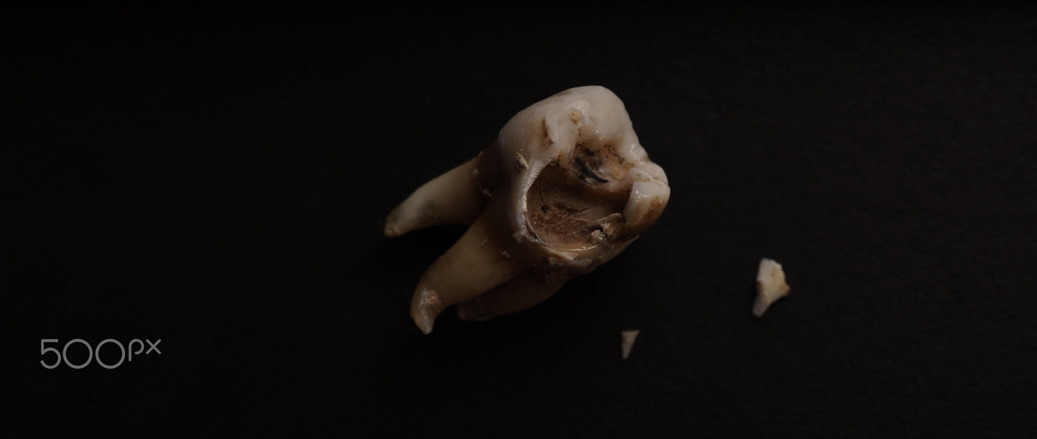 Macro shot of a decayed teeth till root after extraction of dentist.