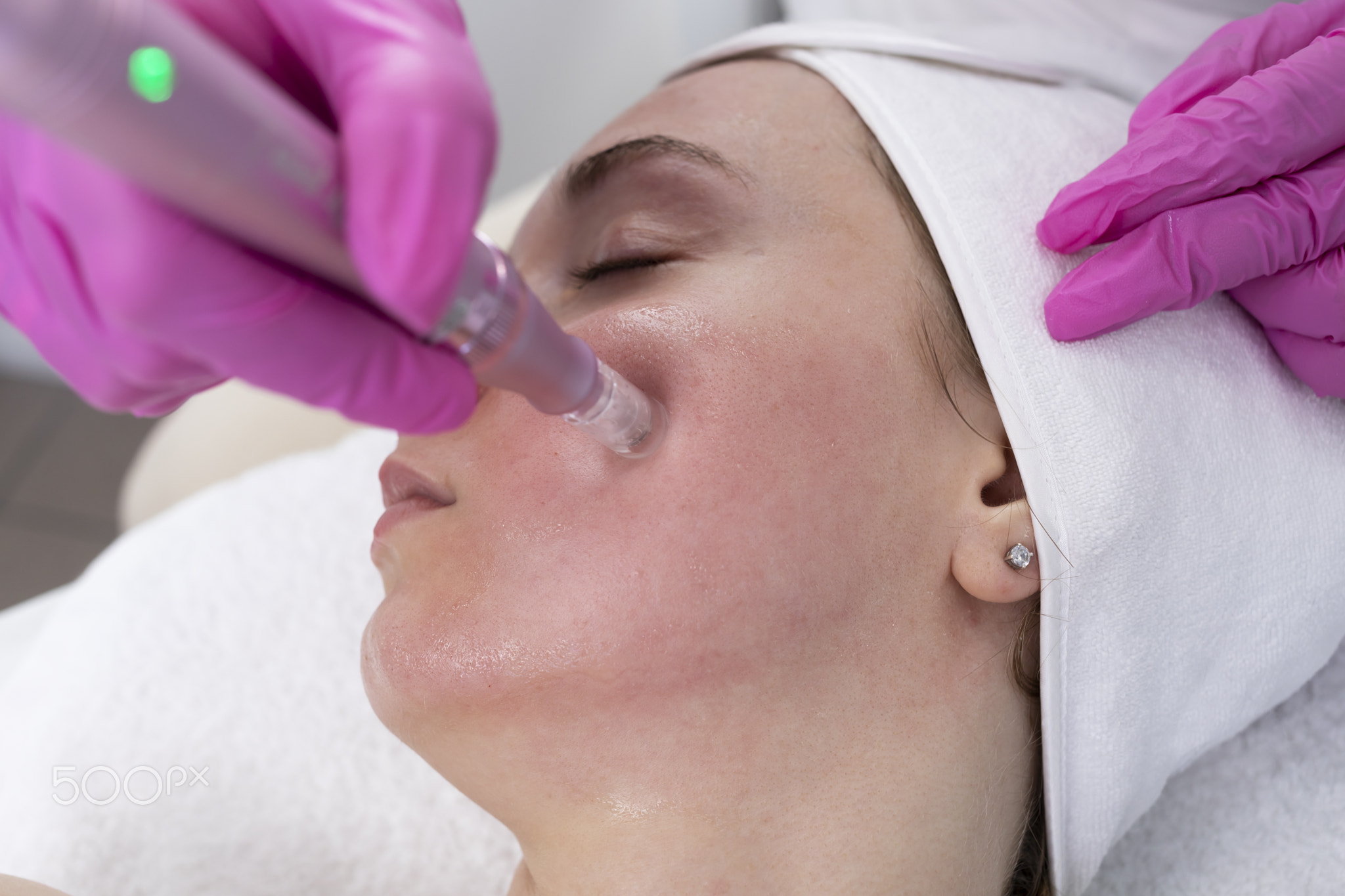 Closeup Cosmetologist Making Mesotherapy Injection With Dermapen On