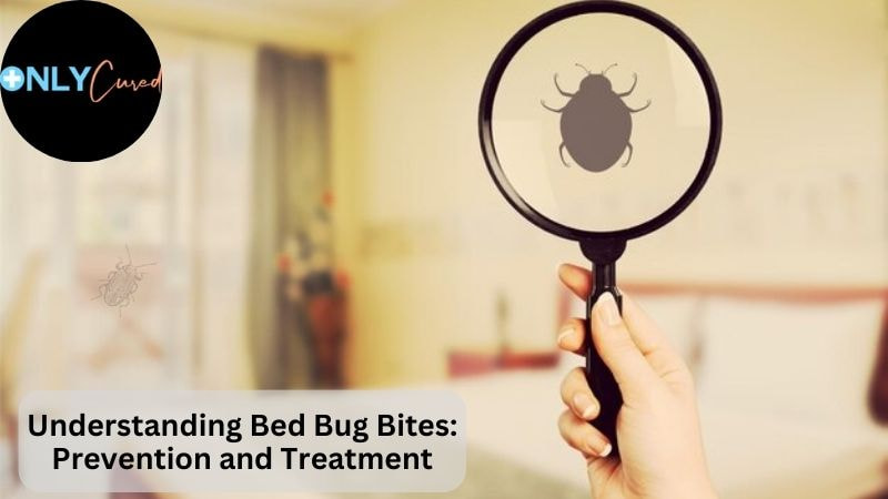 Understanding Bed Bug Bites: Prevention and Treatment