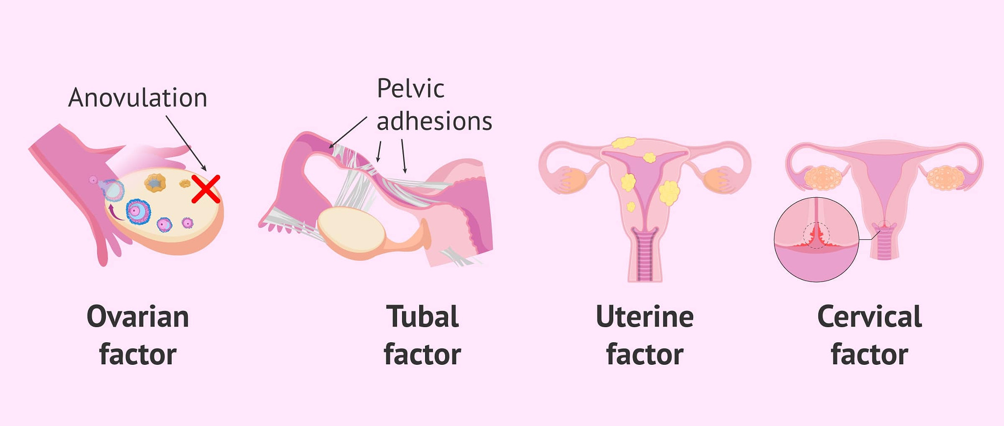 Harmony in Health Ayurvedic Solutions for Female Infertility