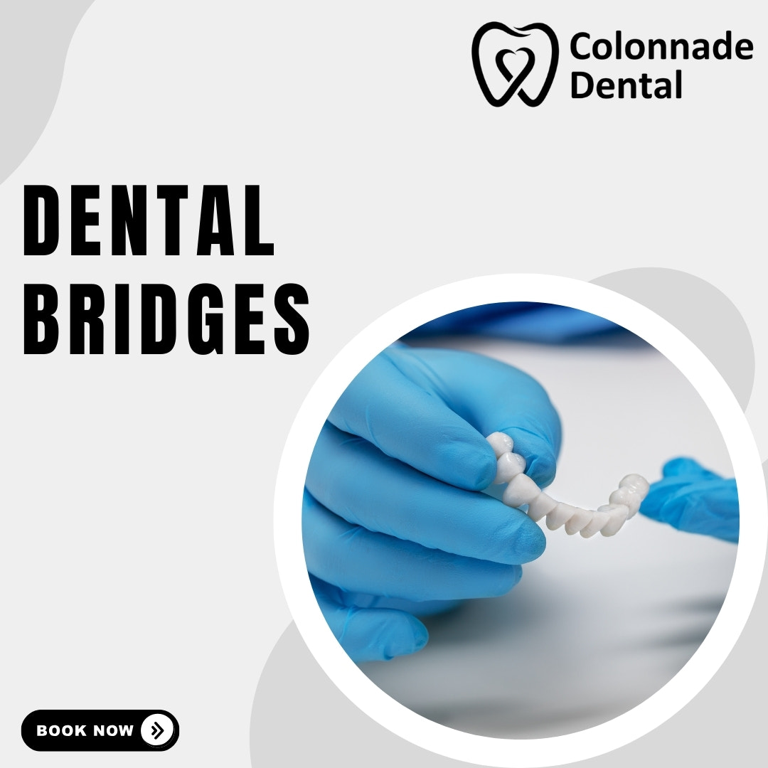 Dental Bridges In Raleigh NC