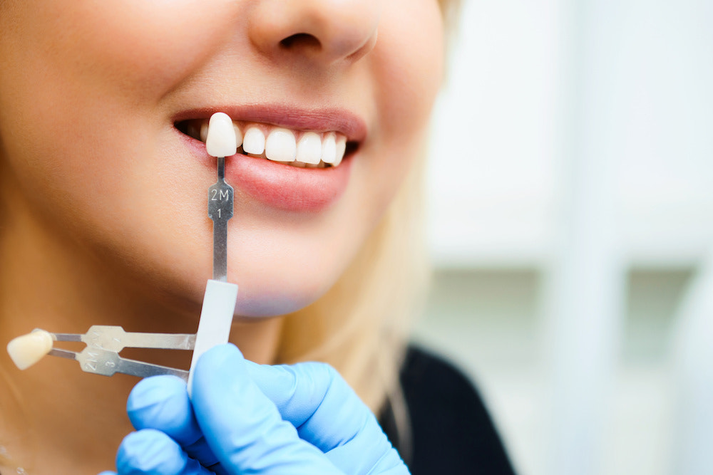 Replacing Missing Teeth | A Comprehensive Guide to Restoration Options