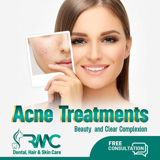 Laser Treatment For Acnes cars in Islamabad - Acnes cars Removal in Islamabad - Best Acnes cars Remo