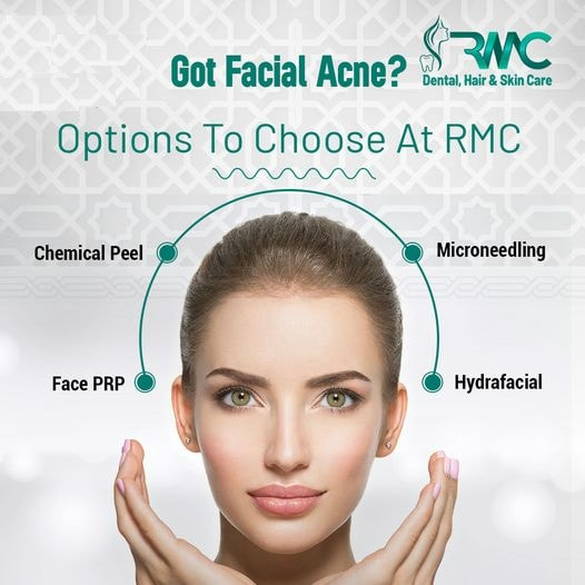 Laser Treatment For Acnes cars in Islamabad - Acnes cars Removal in Islamabad - Best Acnes cars Remo