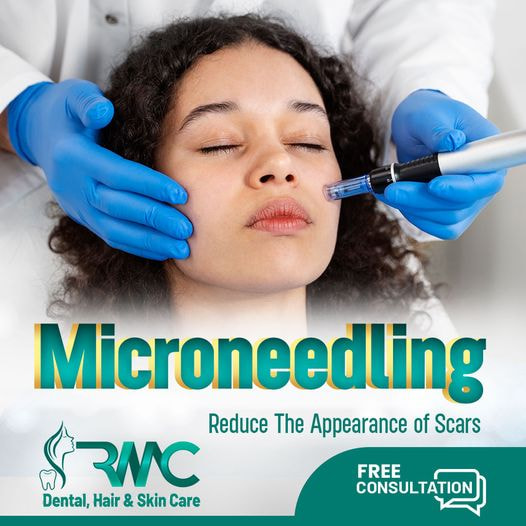 Microneedling Therapy in Islamabad - Best Microneedling Treatment in Islamabad - Microneedling Treat