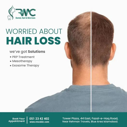PRP Hair Treatment in Islamabad - Hair PRP Treatment in Islamabad - PRP For Hair In Islamabad - PRP
