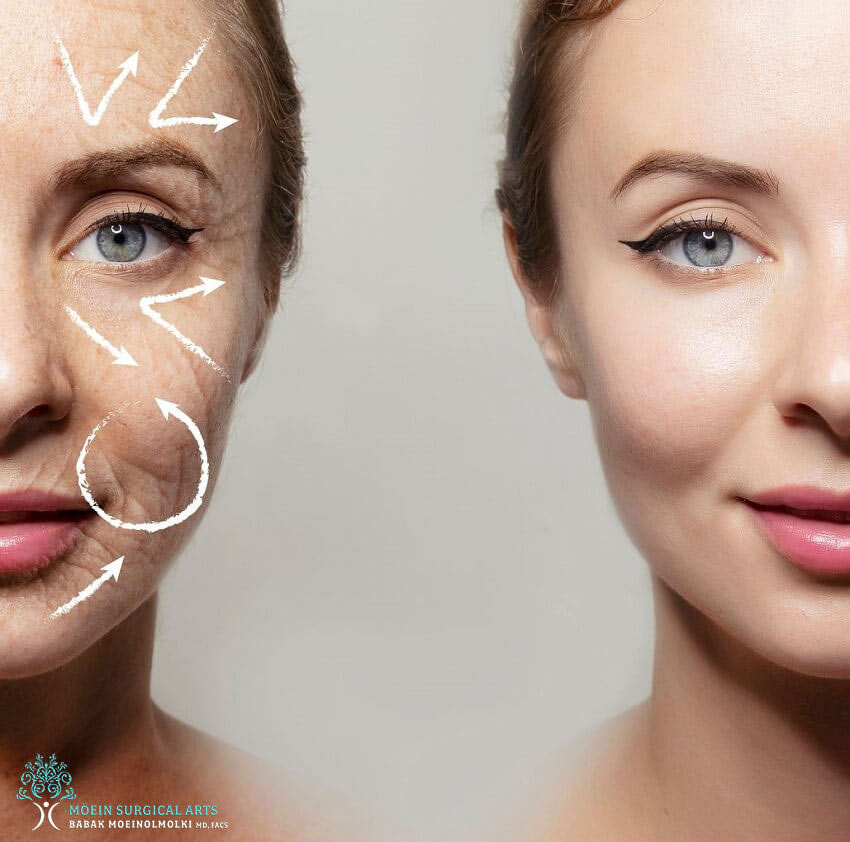 Say Goodbye to Sagging Skin: Unlocking the Power of Forma Skin Tightening Treatments