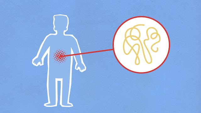 The Connection Between Chronic Inflammation and Diseases: What You Need to Know