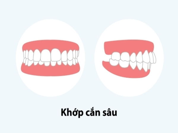 v2?sig=44e09b22e3f9796e9421e5408384e8686