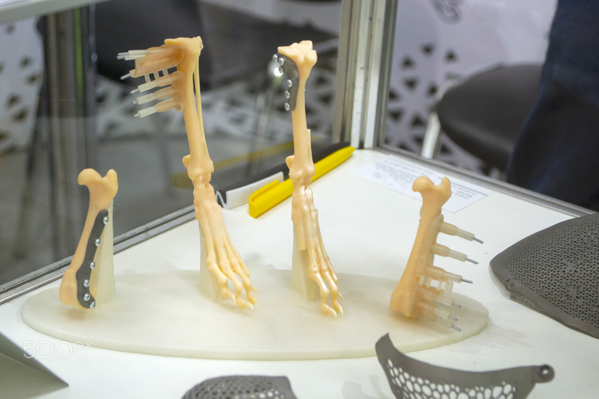 Implants and prostheses printed on 3D printer from biocompatible