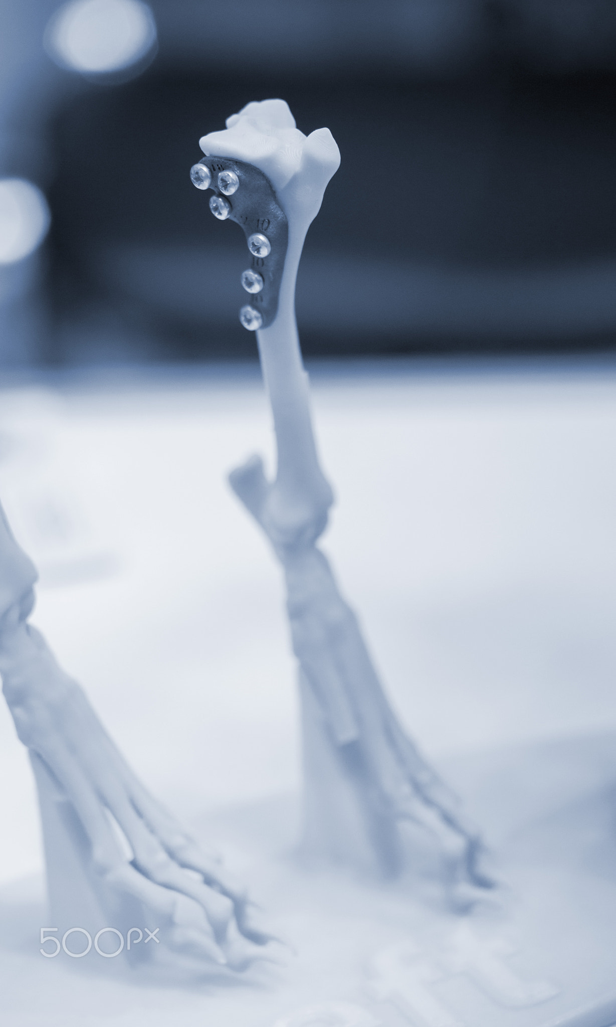 Implants and prostheses printed on 3D printer from biocompatible