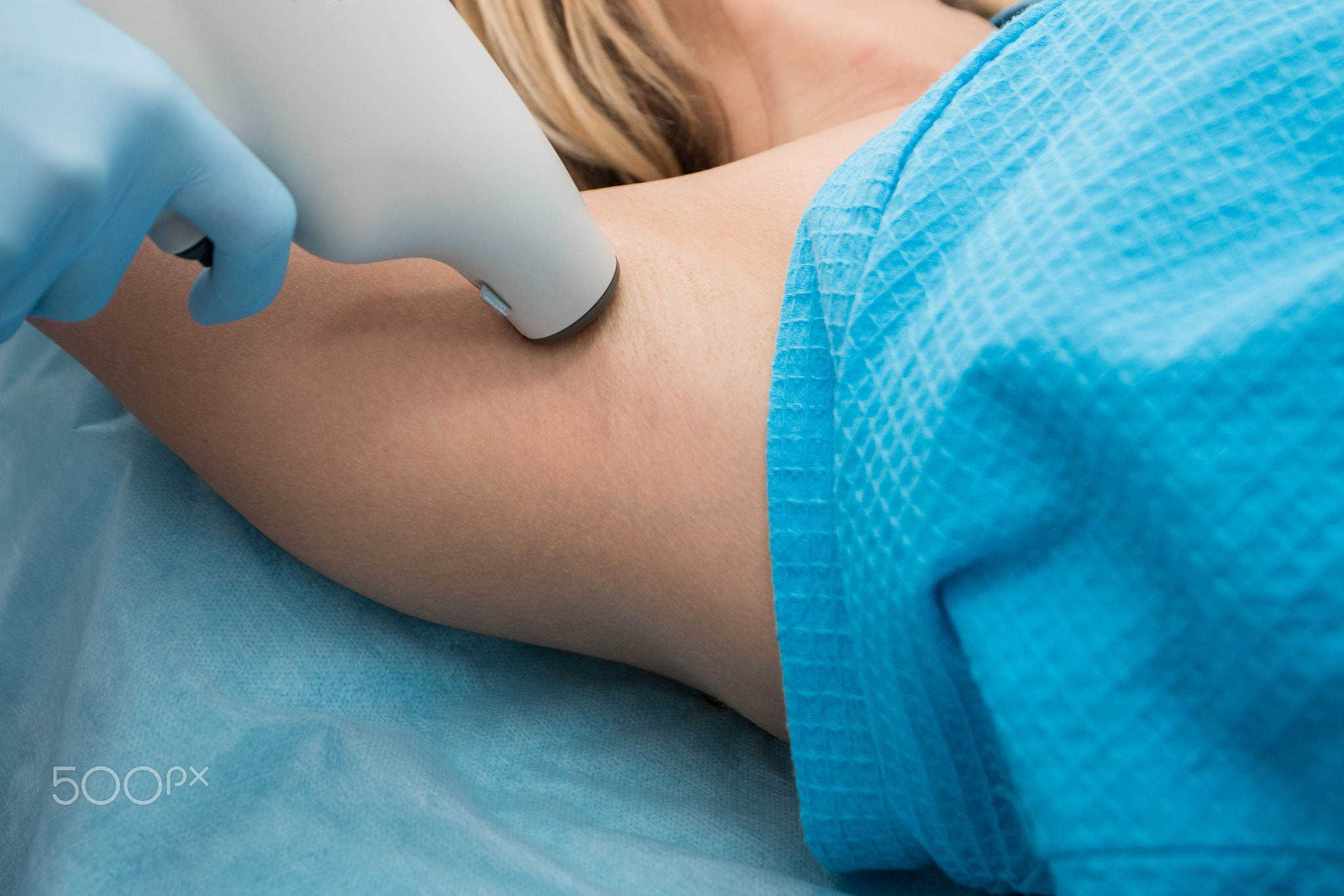 Procedure against hyperhidrosis