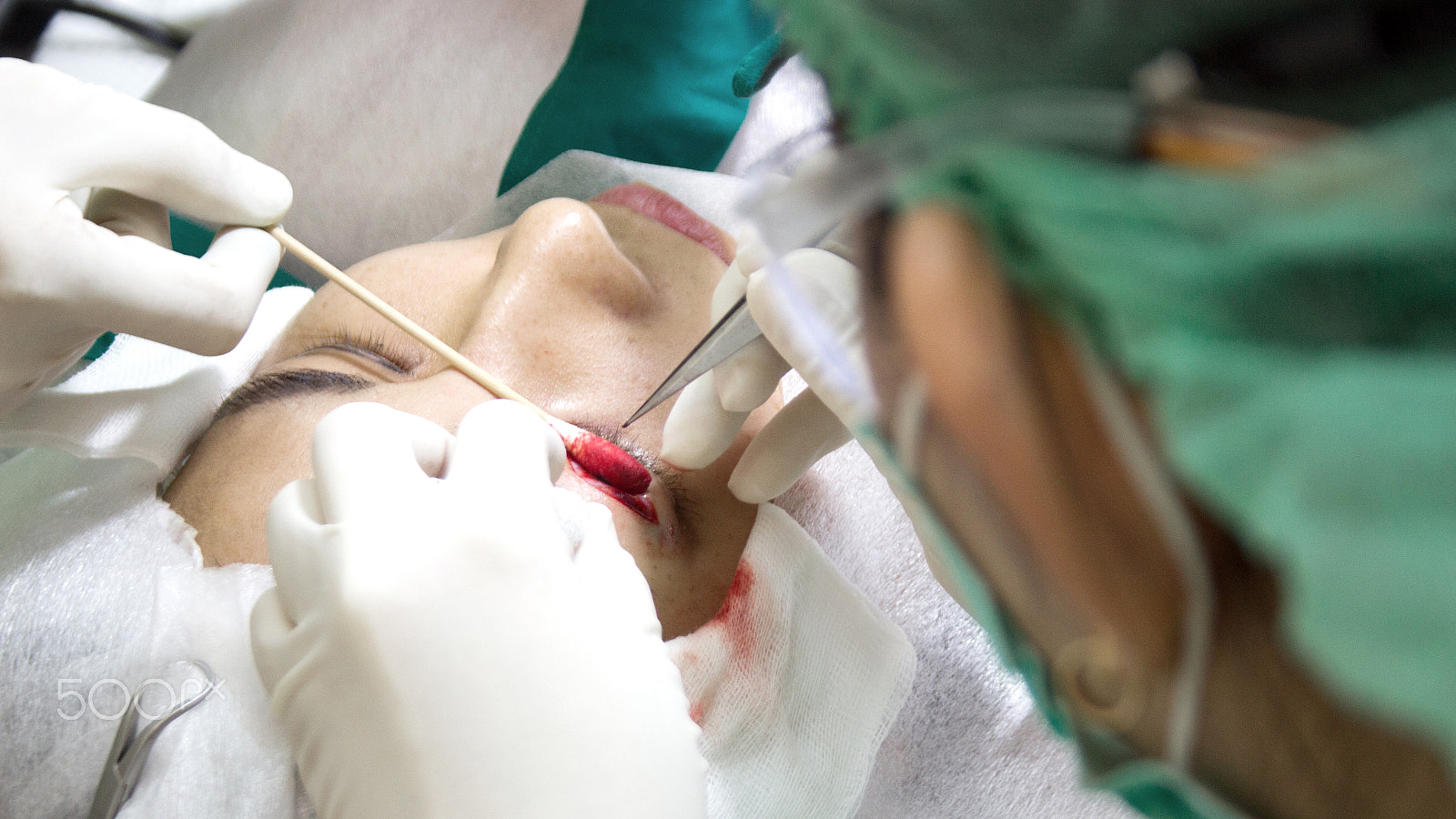 Canon EF-S 18-55mm F3.5-5.6 sample photo. Stop blood feed in er room photography