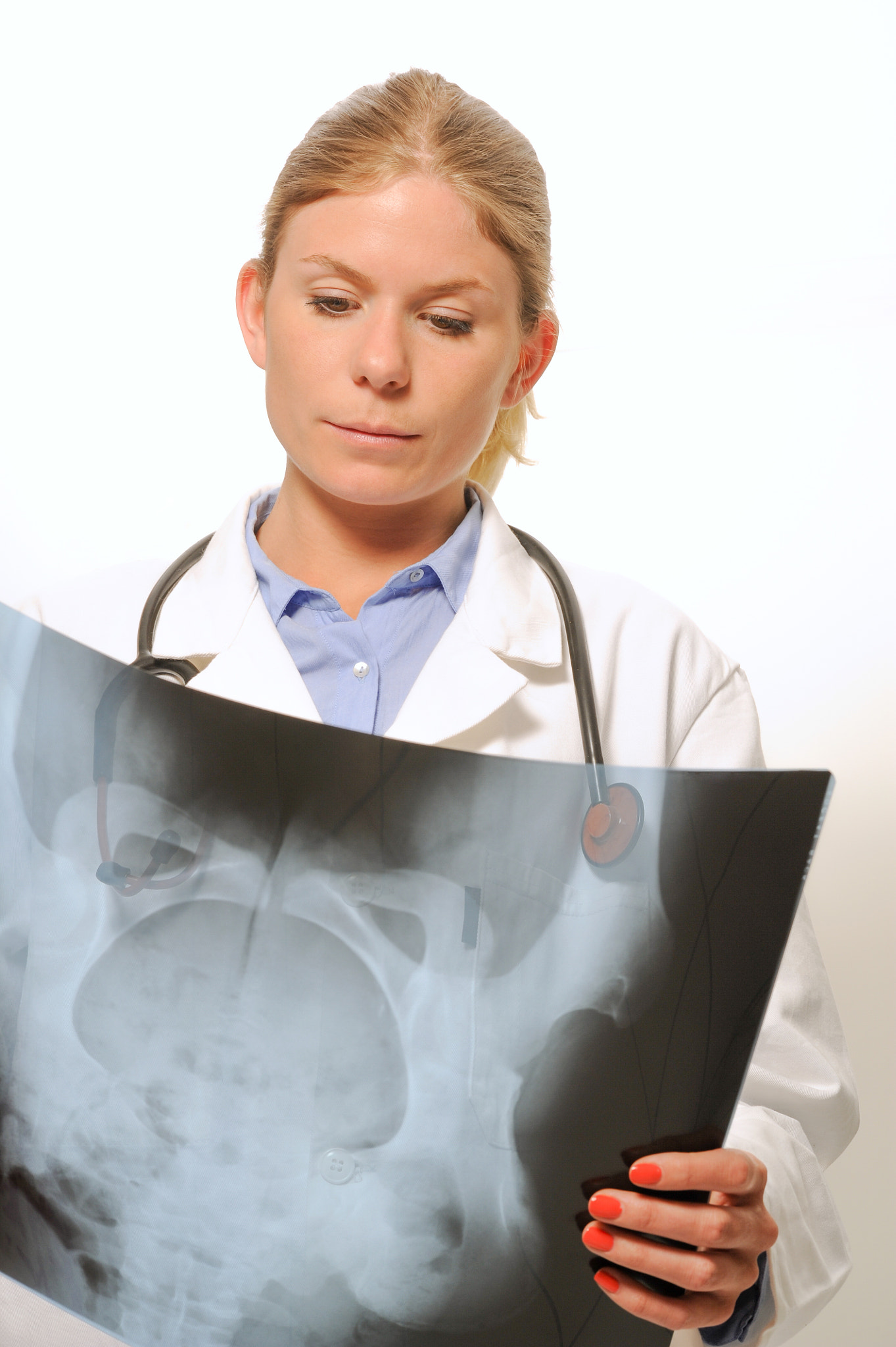 Nikon D3S + Nikon AF-S Nikkor 85mm F1.4G sample photo. Female doctor examining an x-ray image photography