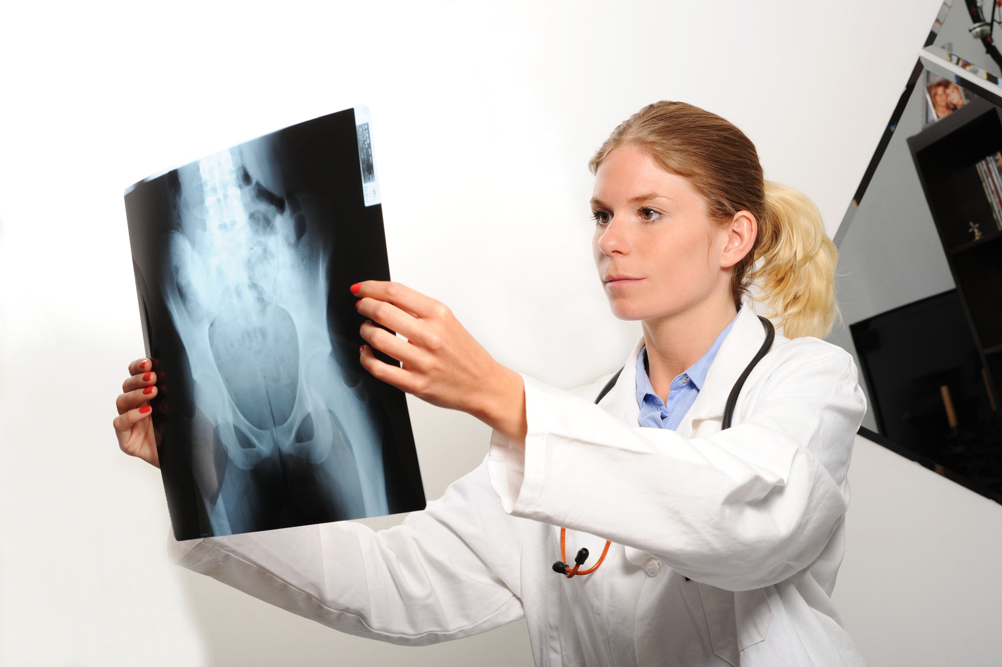 Nikon D3S + Nikon AF-S Nikkor 85mm F1.4G sample photo. Female doctor examining an x-ray image photography