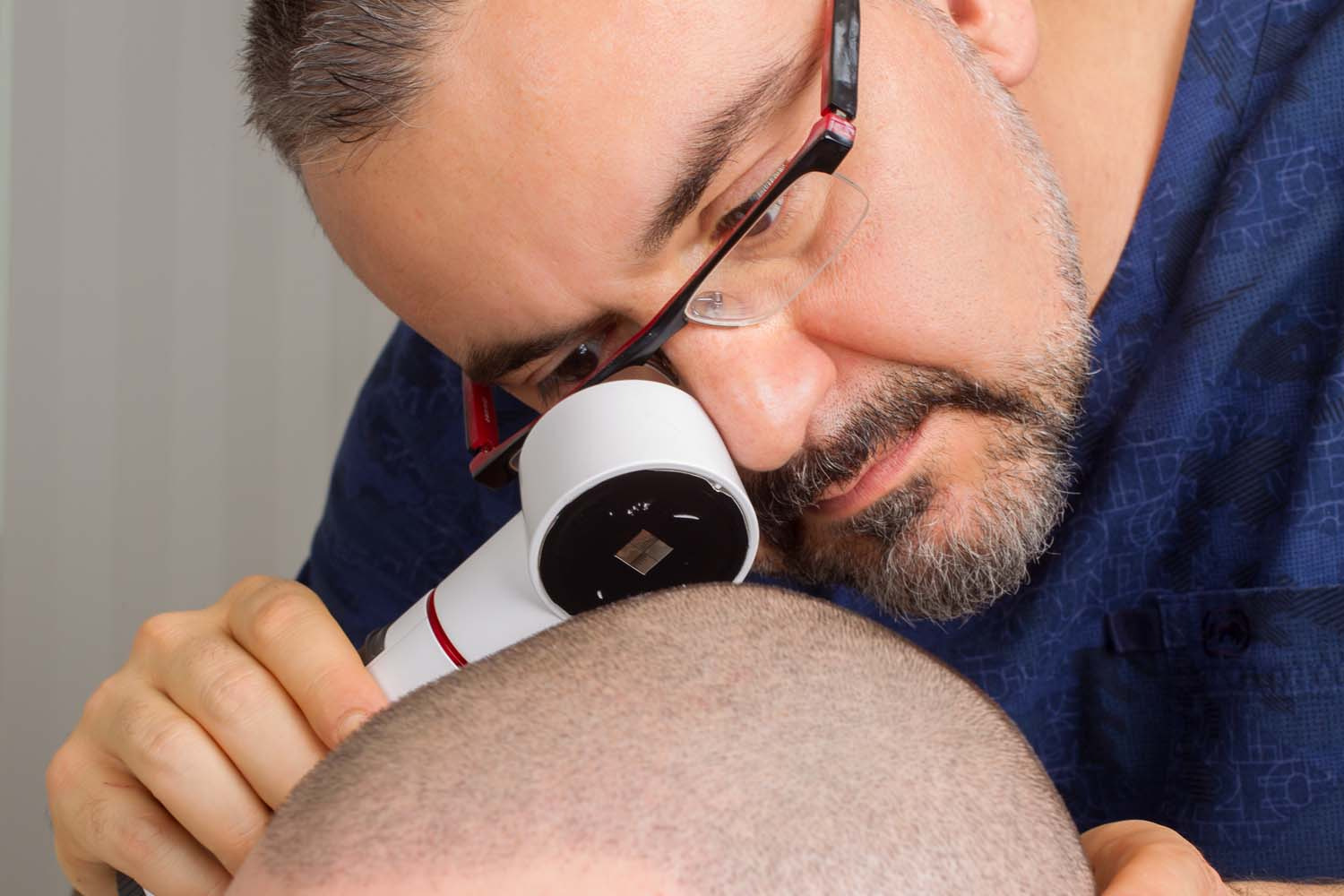 Canon EF 50mm F2.5 Macro sample photo. Hair transplant turkey photography