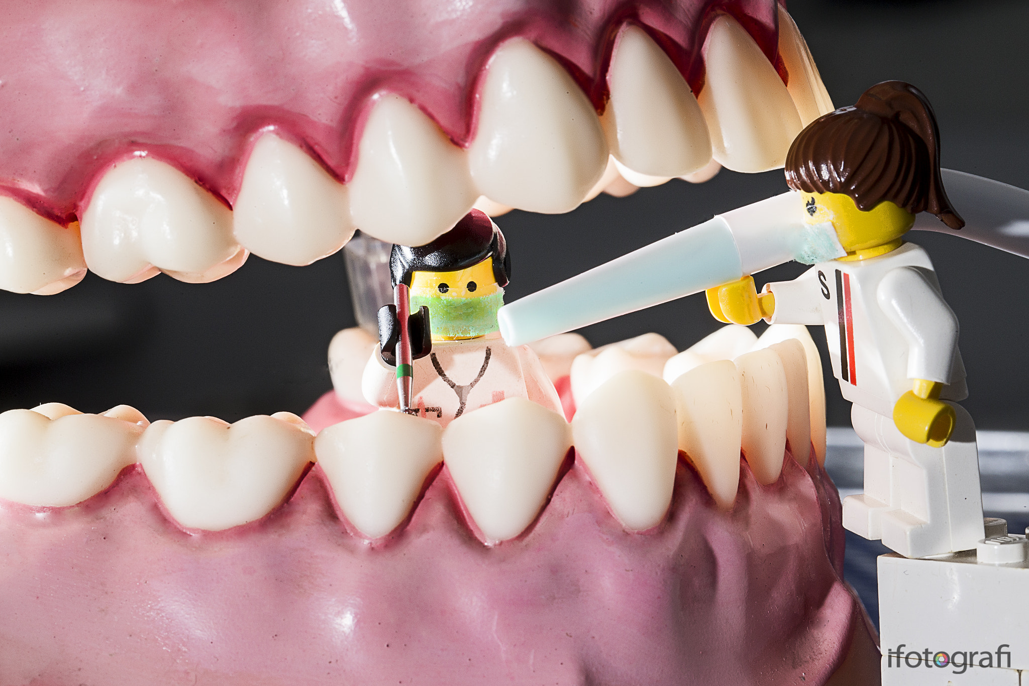 Canon EF 100mm F2.8L Macro IS USM sample photo. Lego dentista photography