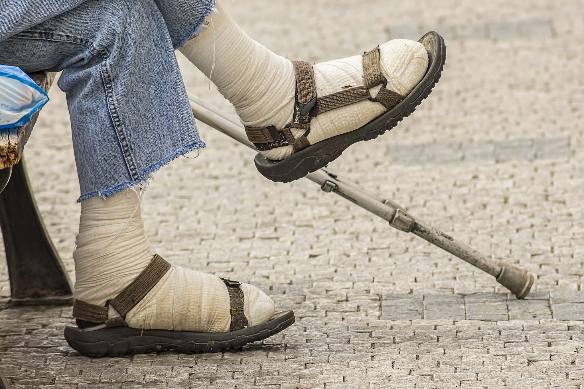 Canon EF 75-300mm F4.0-5.6 IS USM sample photo. Wounded injured or crippled legs of a poor man sitting on a benc photography