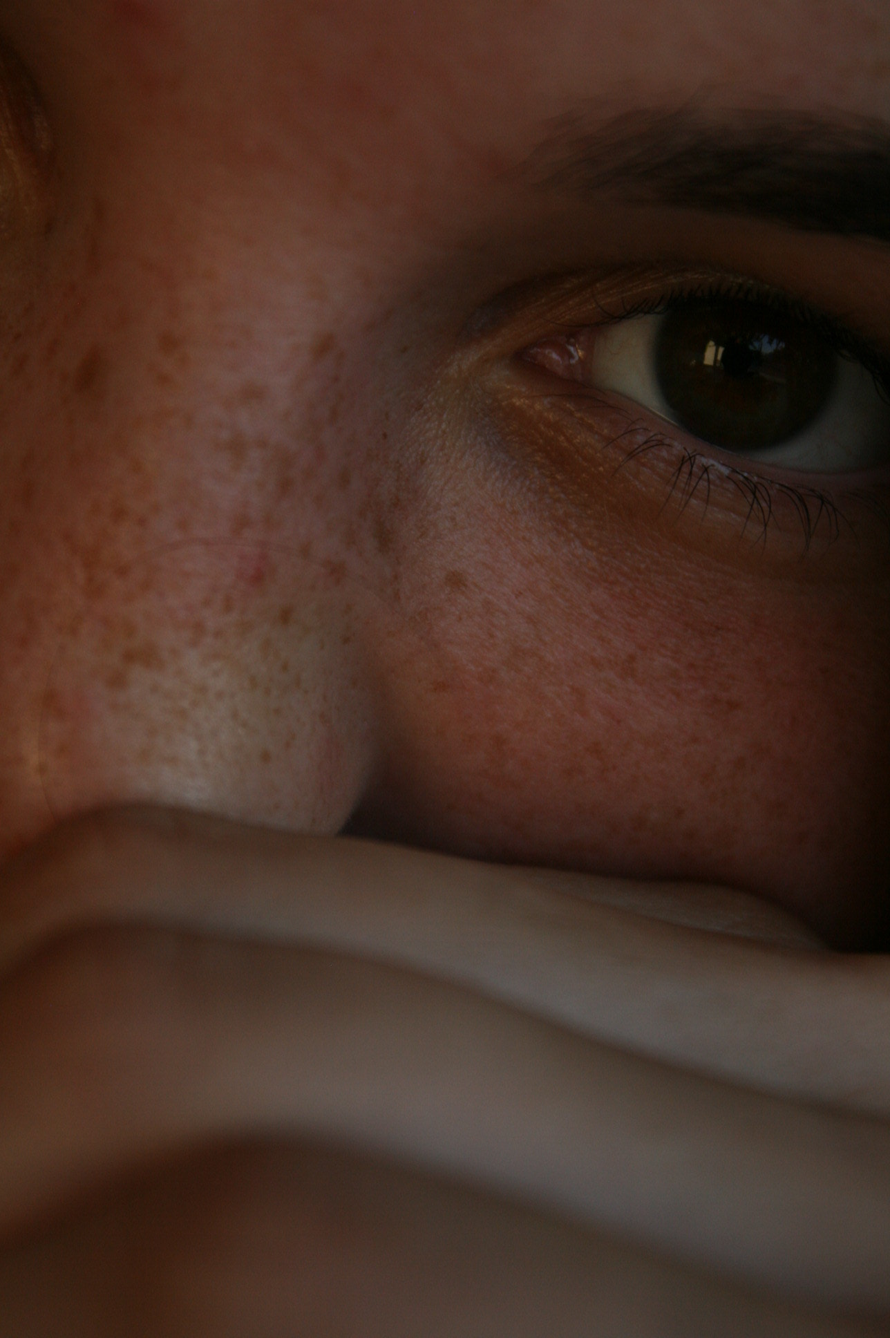 Canon EOS 400D (EOS Digital Rebel XTi / EOS Kiss Digital X) sample photo. Freckles photography