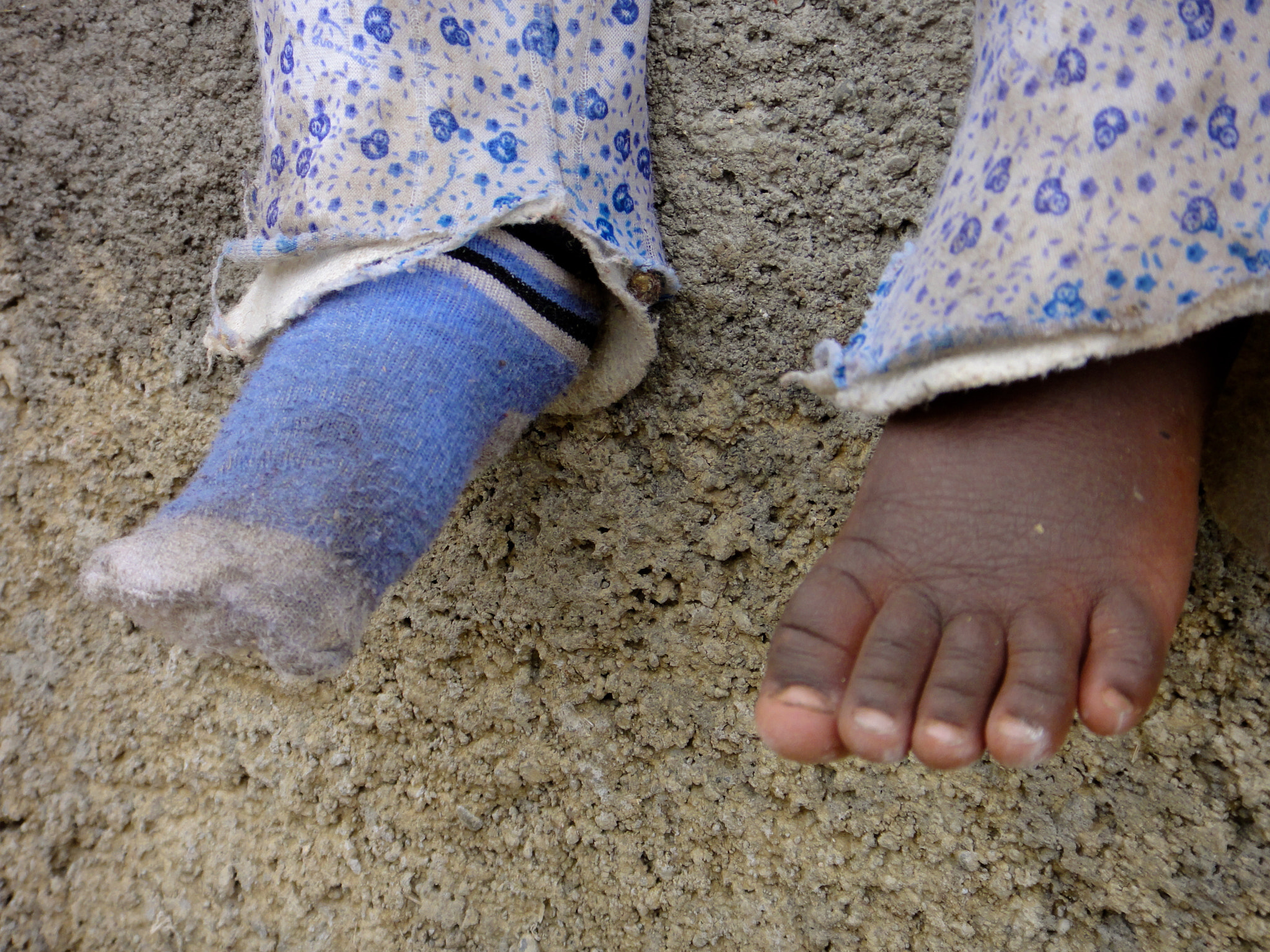 Sony DSC-TX7 sample photo. Ethiopia, dessie, little girl, feet, only one sock, barefoot, dirty pants, poverty, small... photography