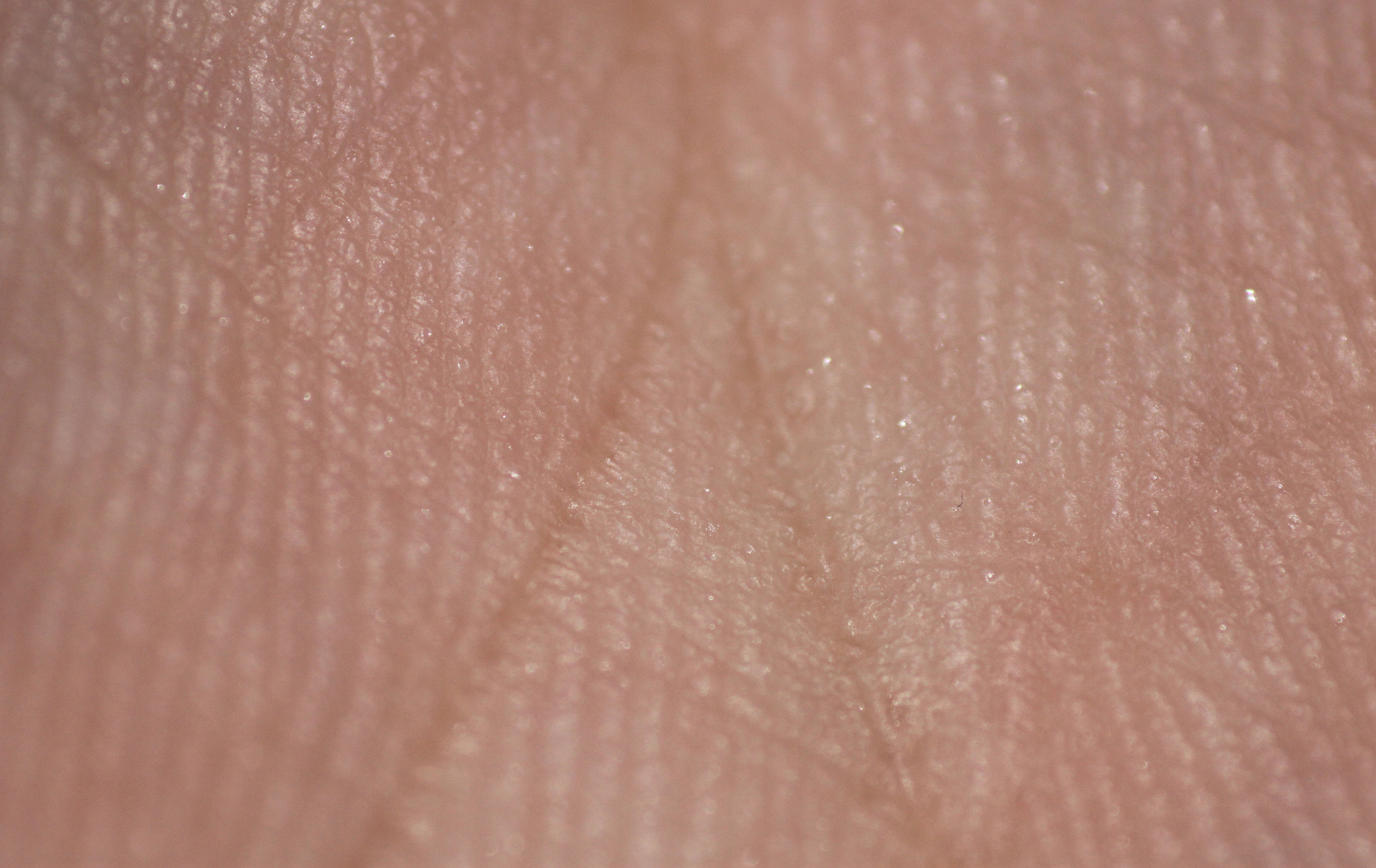 Canon EF 100mm F2.8 Macro USM sample photo. Img photography