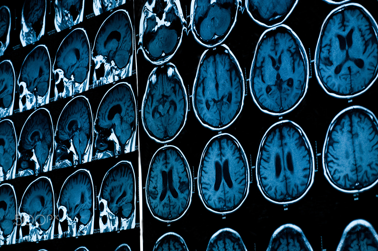 Nikon D300 + Nikon AF-S Nikkor 50mm F1.8G sample photo. Research in medicine. ct scan of the patient. photography