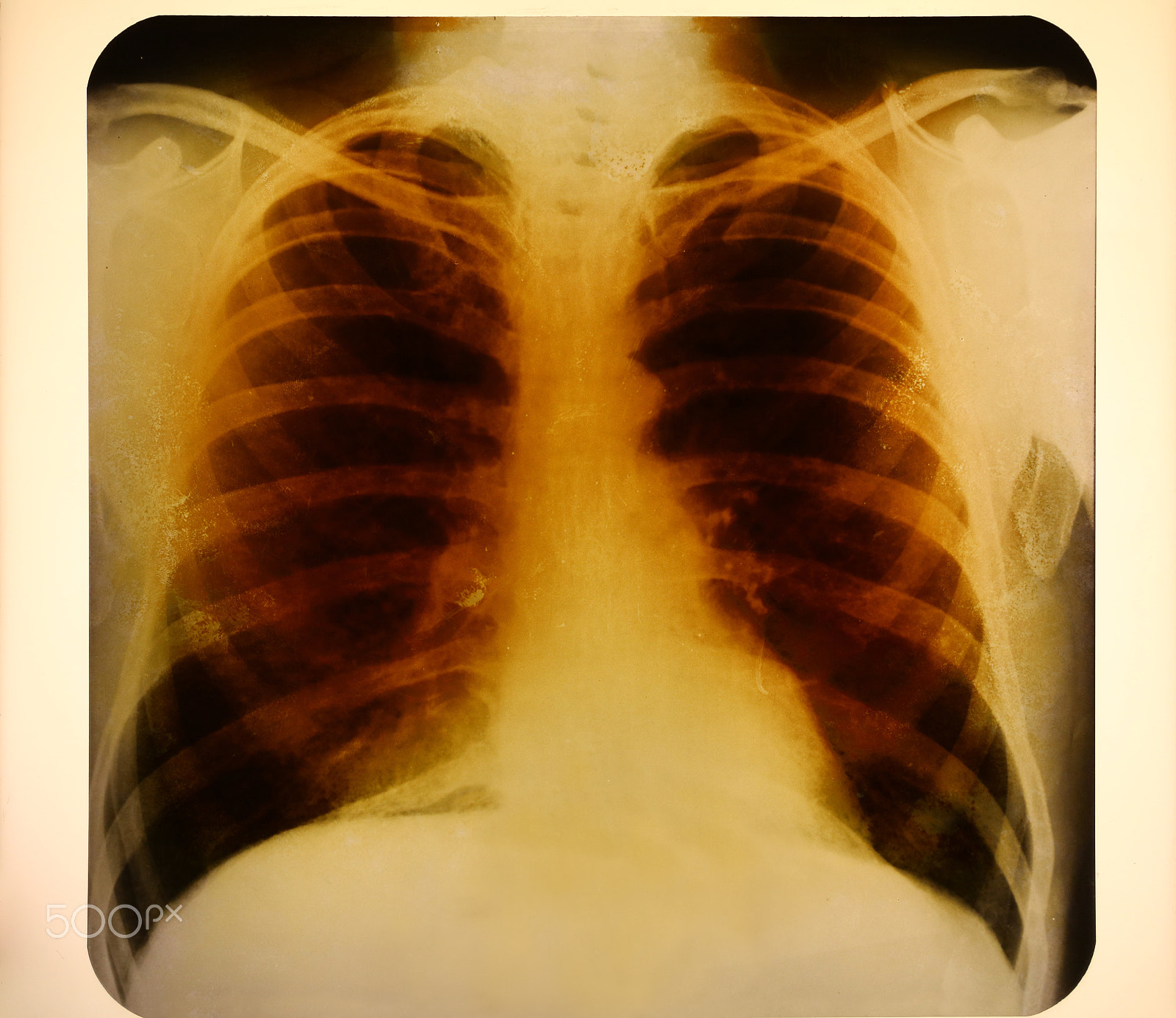 Canon EOS 5DS sample photo. X-ray lungs examination, photofluorogram photography