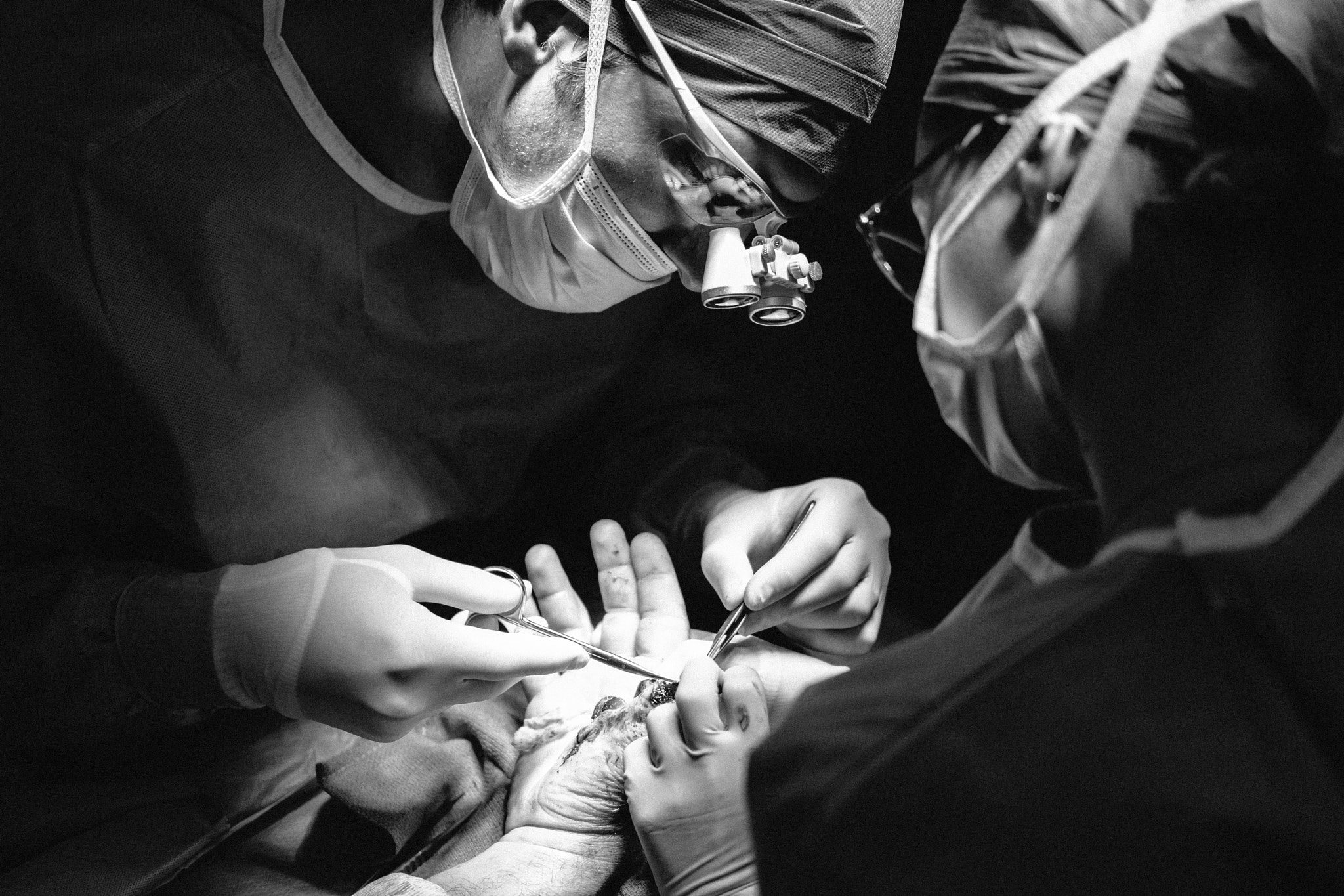Fujifilm X-E2 + Fujifilm XF 35mm F2 R WR sample photo. Hand surgery #2 photography