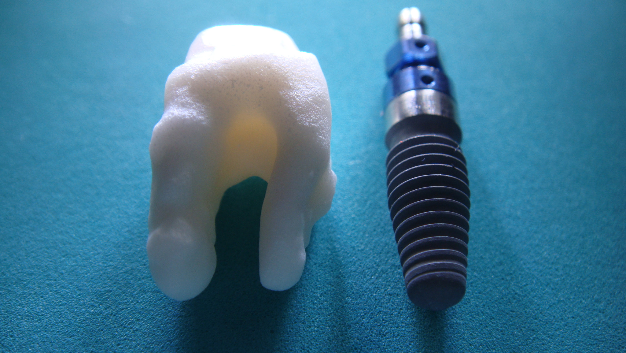 Sony DSC-T700 sample photo. Dental implants hammond, louisiana photography