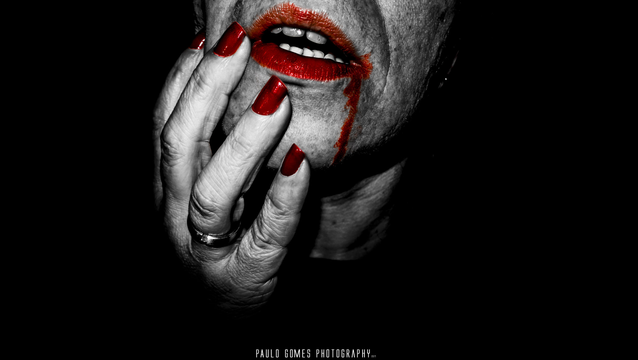 Nikon 1 J5 sample photo. Wound photography
