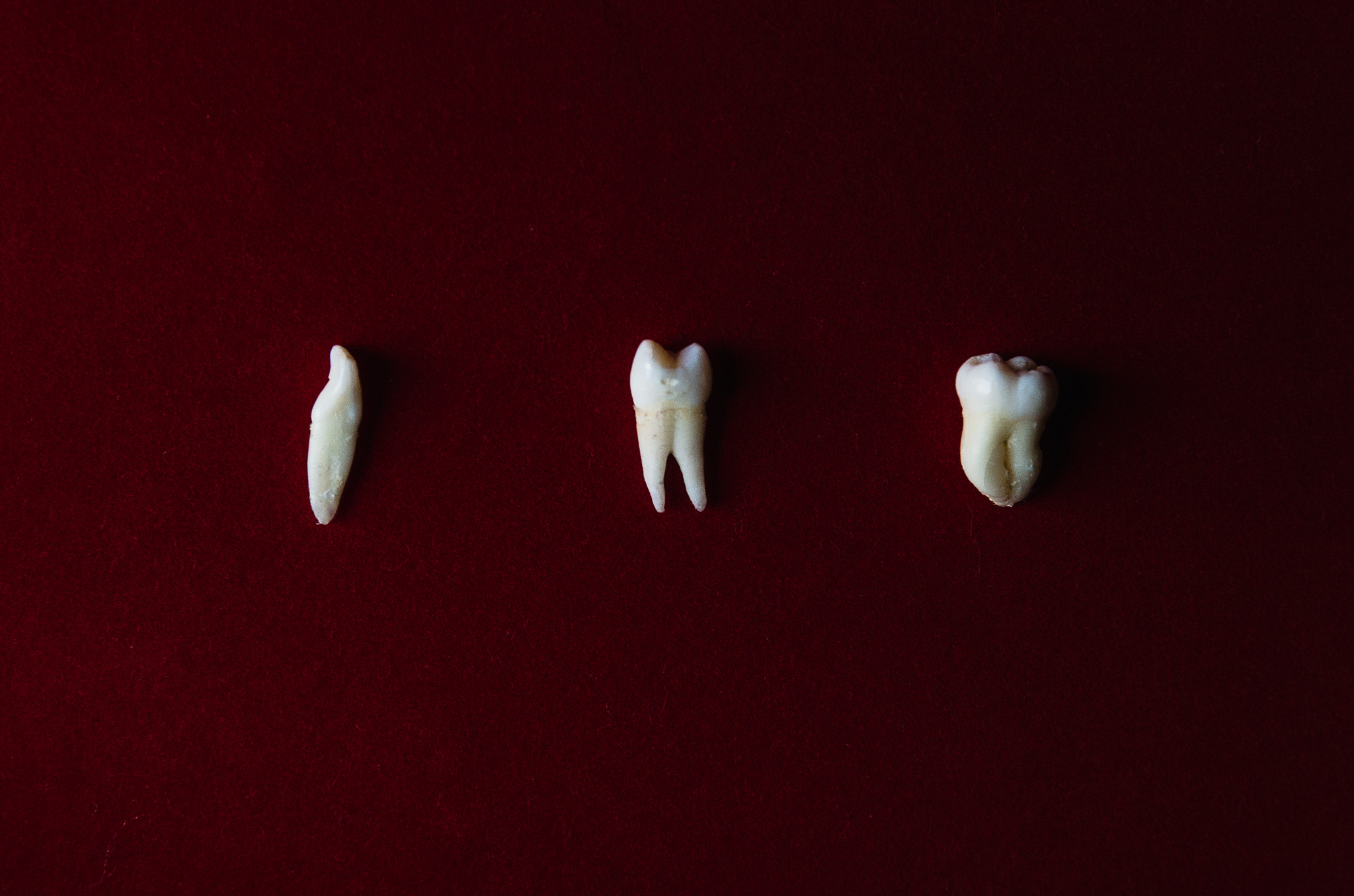 Sigma 17-50mm F2.8 EX DC HSM sample photo. Teeth photography