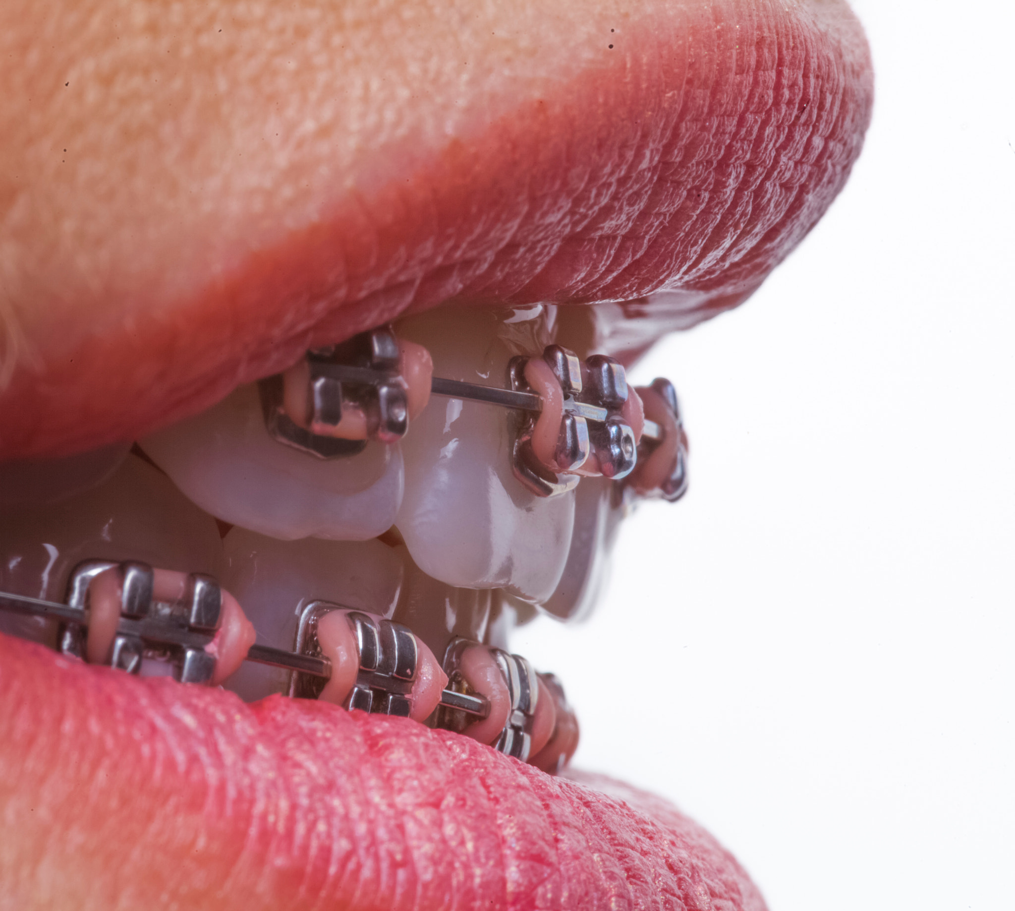 Sigma 105mm F2.8 EX DG OS HSM sample photo. Braces photography
