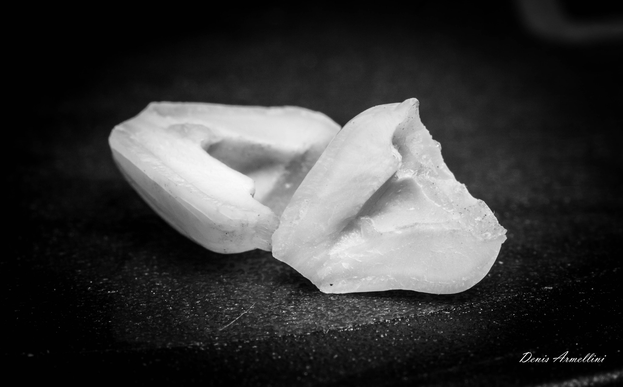 Canon EF 100mm F2.8L Macro IS USM sample photo. A tooth photography