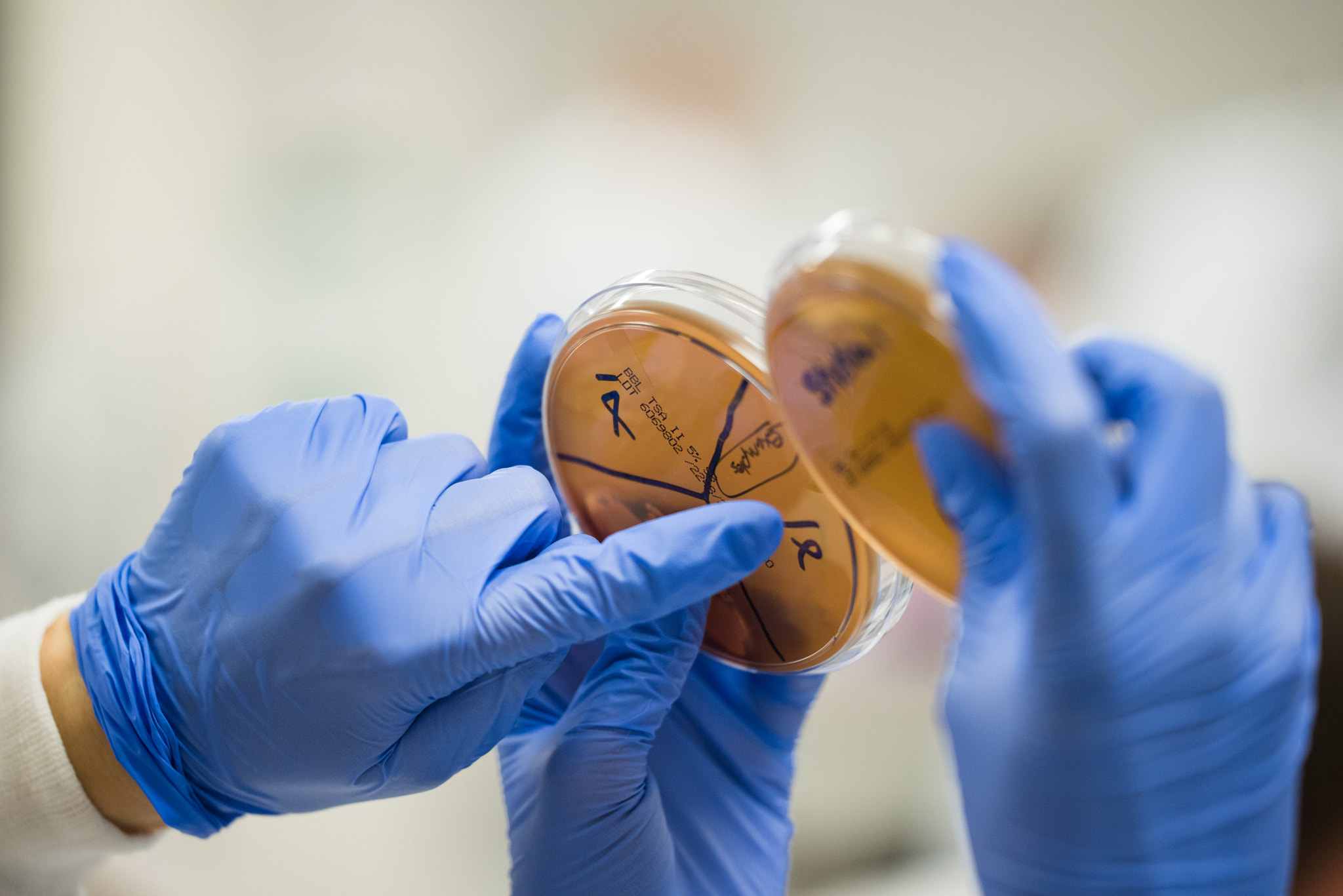 Sigma 150mm F2.8 EX DG OS Macro HSM sample photo. Specimens and blue gloves photography