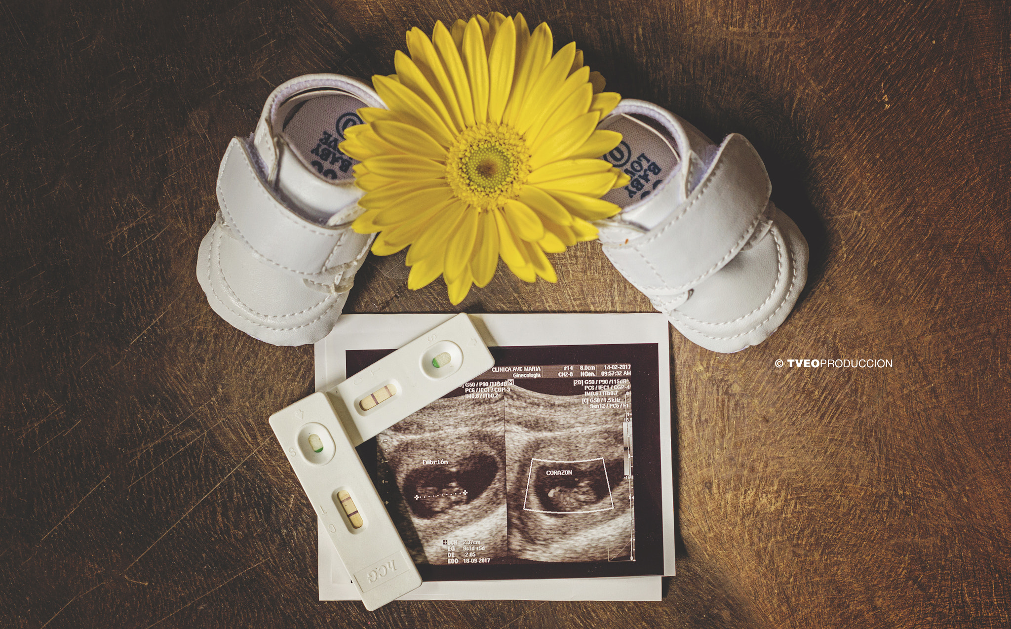 Canon EF 35-80mm f/4-5.6 sample photo. Pregnancy photography