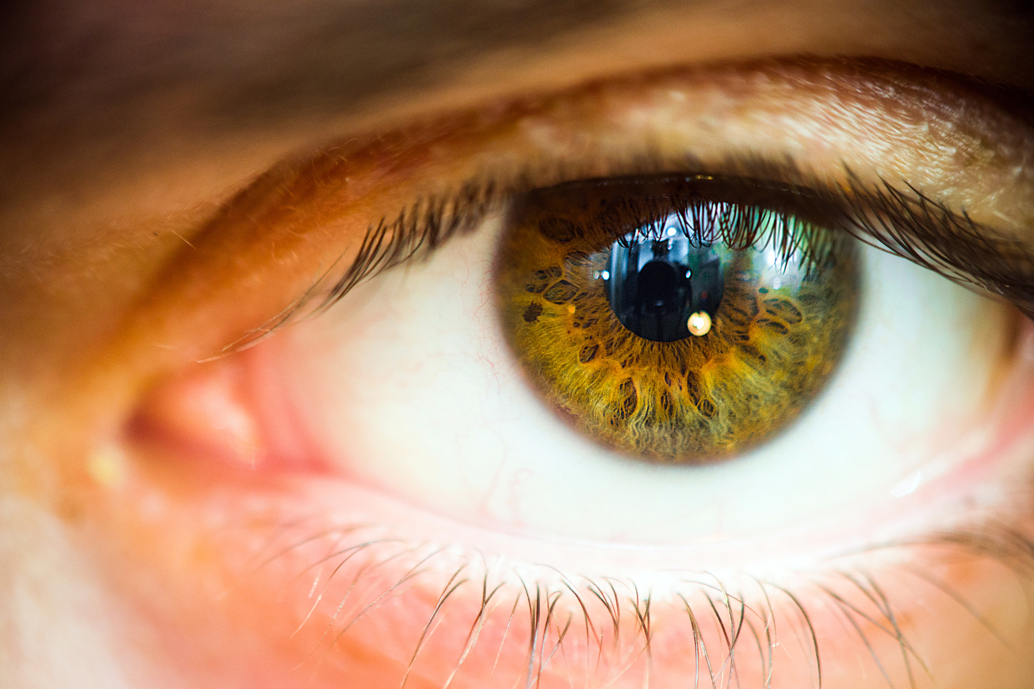 My eye