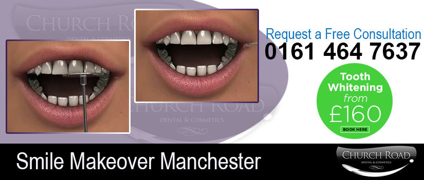 Smile Dentist Manchester | Didsbury Dental Practic