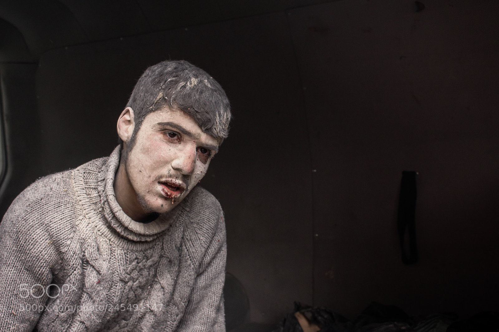 Canon EOS 650D (EOS Rebel T4i / EOS Kiss X6i) sample photo. Injured after bombing photography