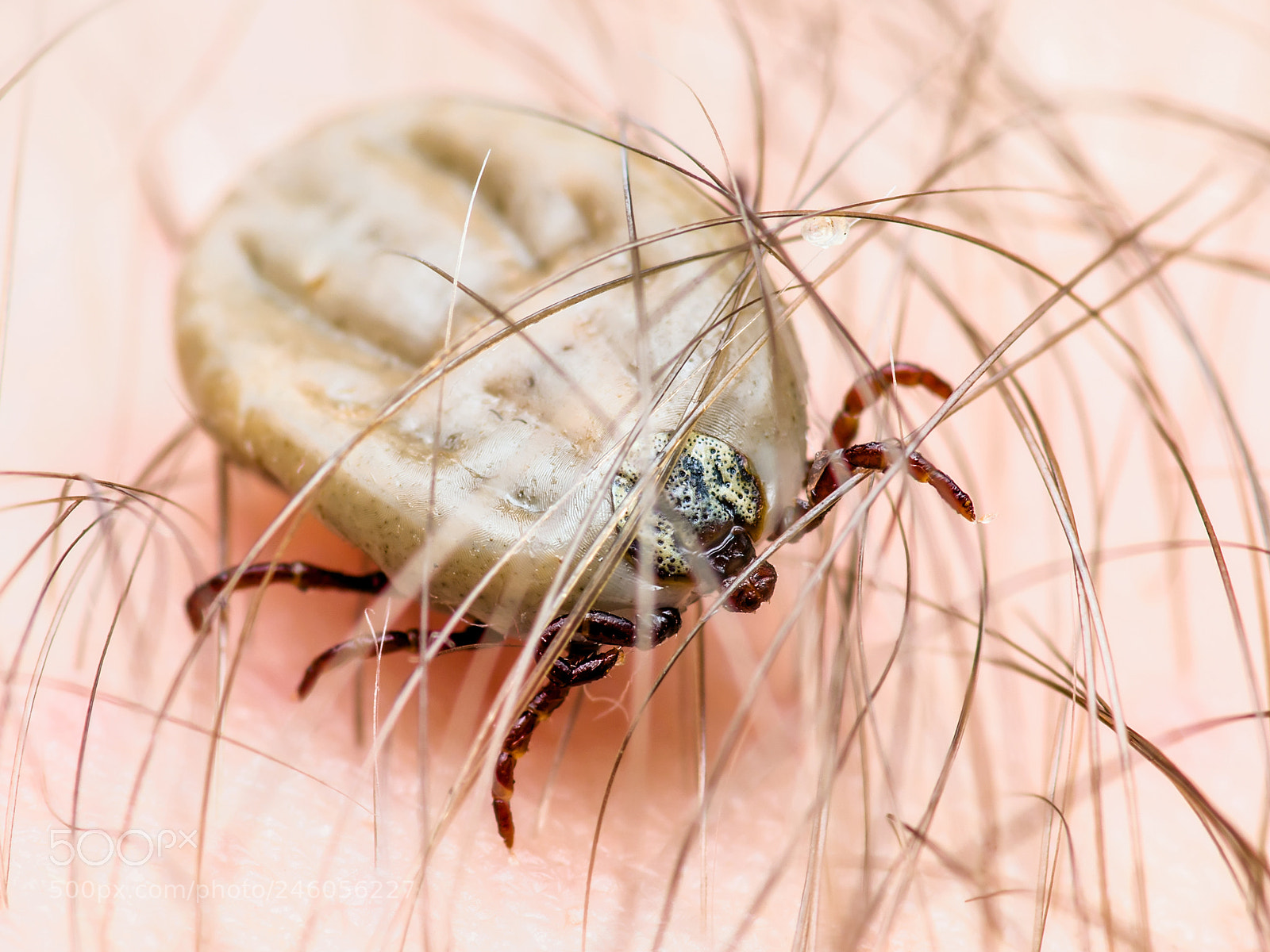 Pentax K-30 sample photo. Encephalitis virus or lyme photography