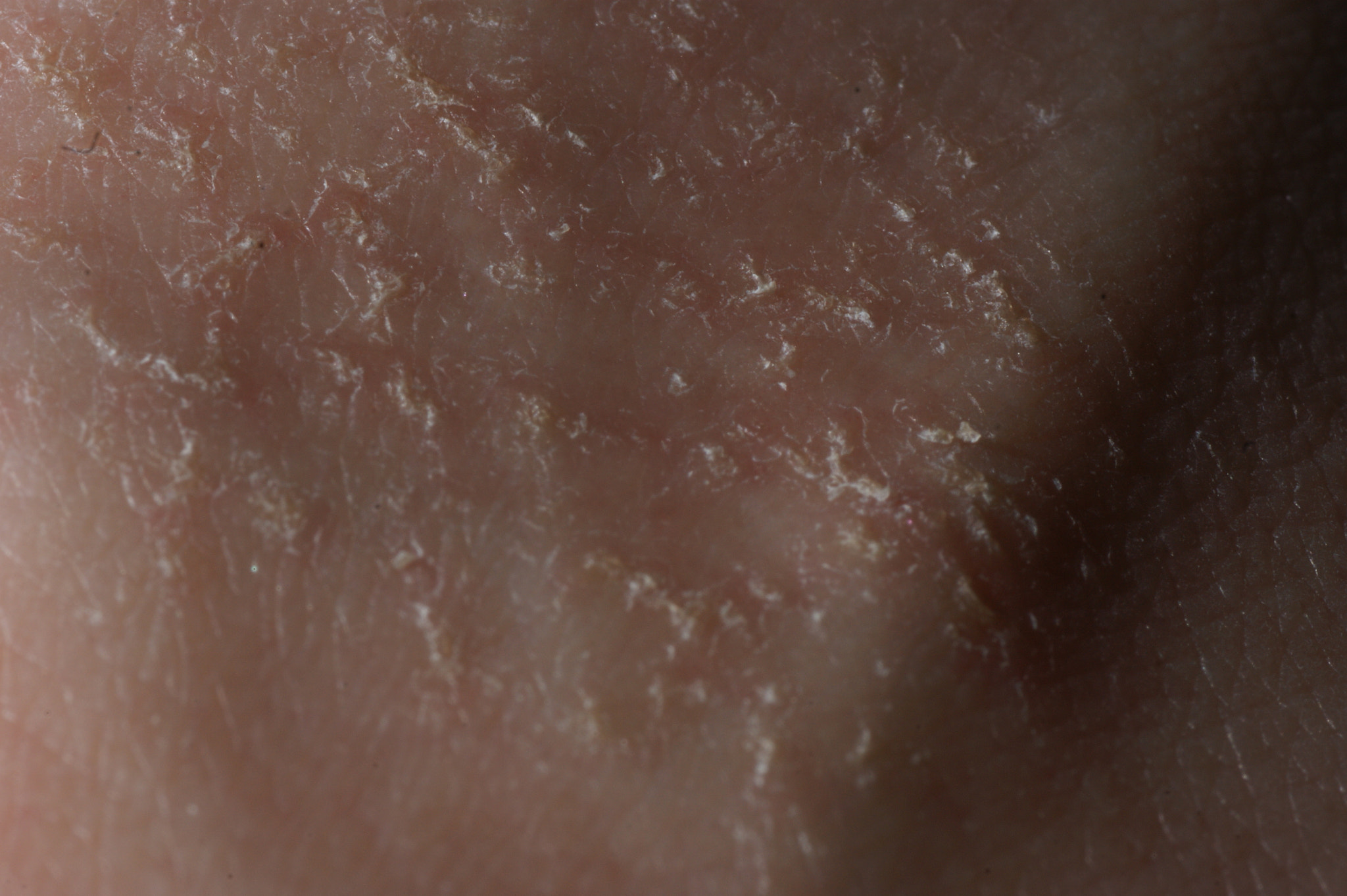 Sony Alpha DSLR-A350 sample photo. Human skin macro photography