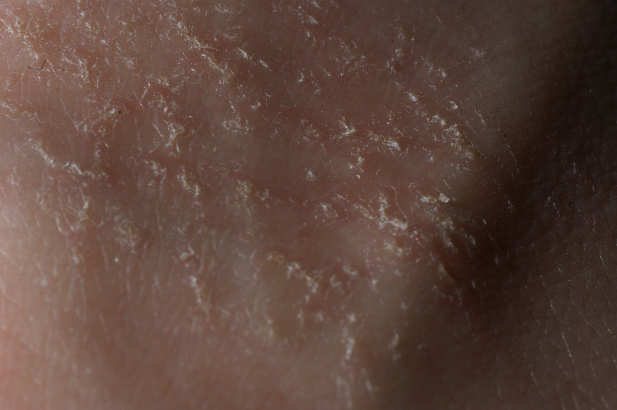 Sony Alpha DSLR-A350 + Tamron SP AF 90mm F2.8 Di Macro sample photo. Human skin macro photography