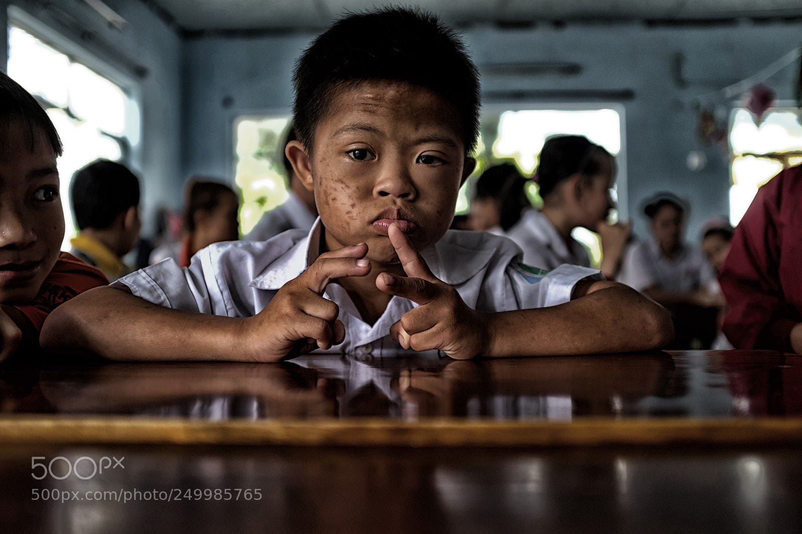 Fujifilm X100F sample photo. Agent orange victims in photography