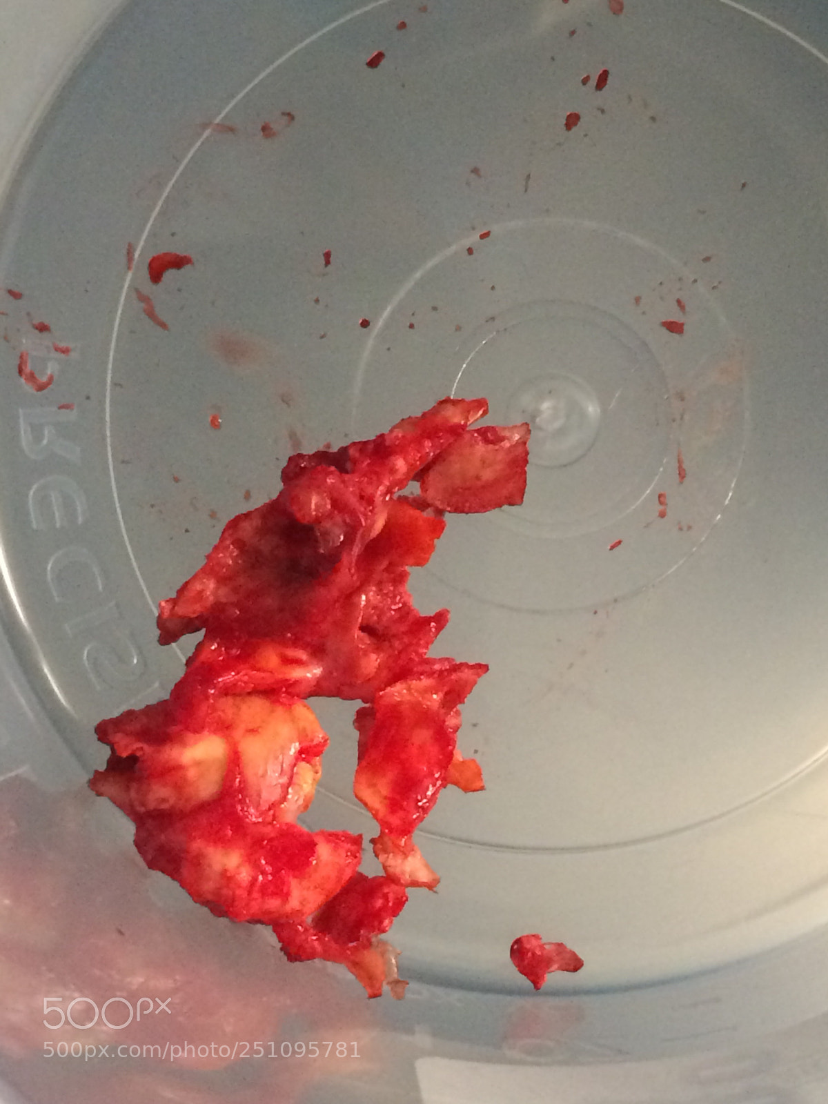 Apple iPhone 5s sample photo. Carotid artery plaque that photography