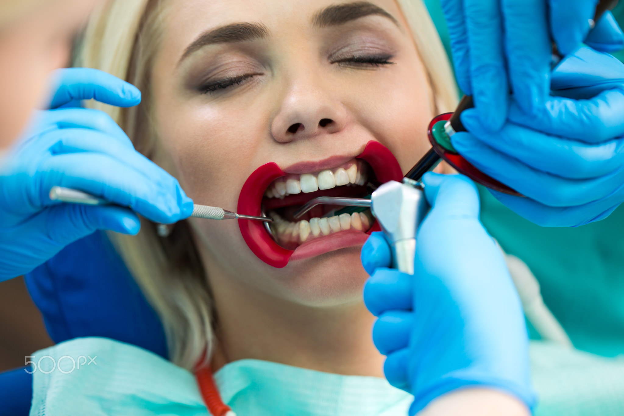 Dentists hands working on young woman patient with dental tools. Female patient with retractor at...