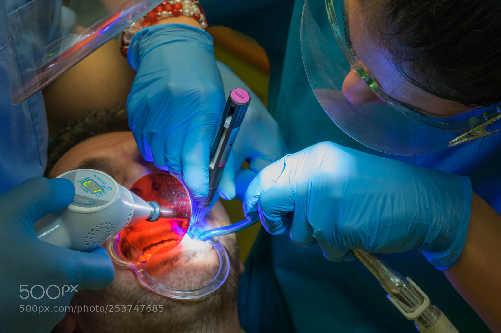 Nikon D5300 sample photo. Dental art photography